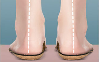 Free Foot Assessments at Hawley Lane Shoes, CT